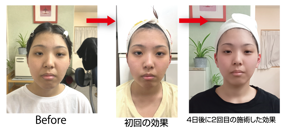 施術例写真